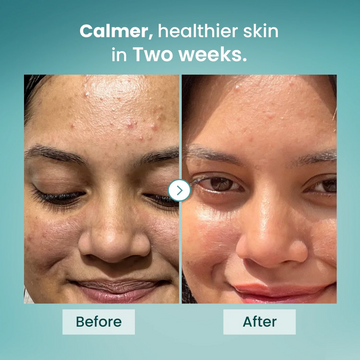 Oil-Free Moisturizer - Quick absorb & instant glow + hydration