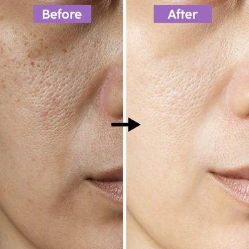 VT Cosmetics Cica Reedle Shot 100 | Micro-Spicule Booster with 95,000 Cica Reedles | Pore Minimizing, Texture Refinement & Skin Renewal