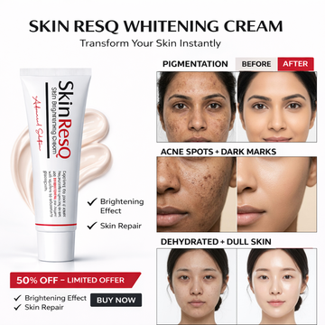 Skin Resq Whitening Cream | Brightening Gel Cream with Alpha Arbutin, Kojic Acid, Niacinamide & Vitamin C | Fades Pigmentation, Acne Spots & Dark Marks