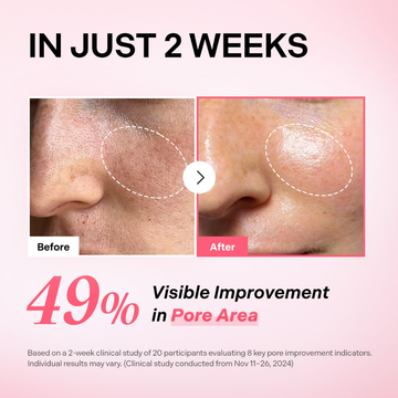 Torriden Cellmazing Pore Perfecting Ampoule | 5D Collagen + Low Molecular Collagen | Tightens Pores, Removes Blackheads & Smooths Texture | 49% Pore Area Improvement in 2 Weeks