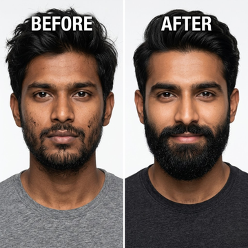 Dr. Alies Professional Beard Growth Oil – 50% OFF – From Patchy to Powerful – Helps Reduce Patchiness, Natural Beard Nourishment – With Castor Oil, Sweet Almond Oil & Vitamin E – Paraben & Silicone Free – For All Skin Types